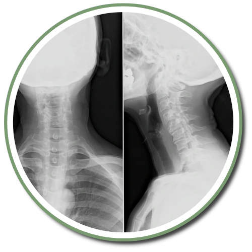 X-rays